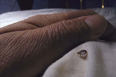 close-up photo of a bed bug approaching a person