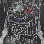 Diagram illustrating leaky gut, showing gaps in the intestinal lining allowing toxins and food particles to enter the bloodstream, contrasting with a healthy gut barrier.