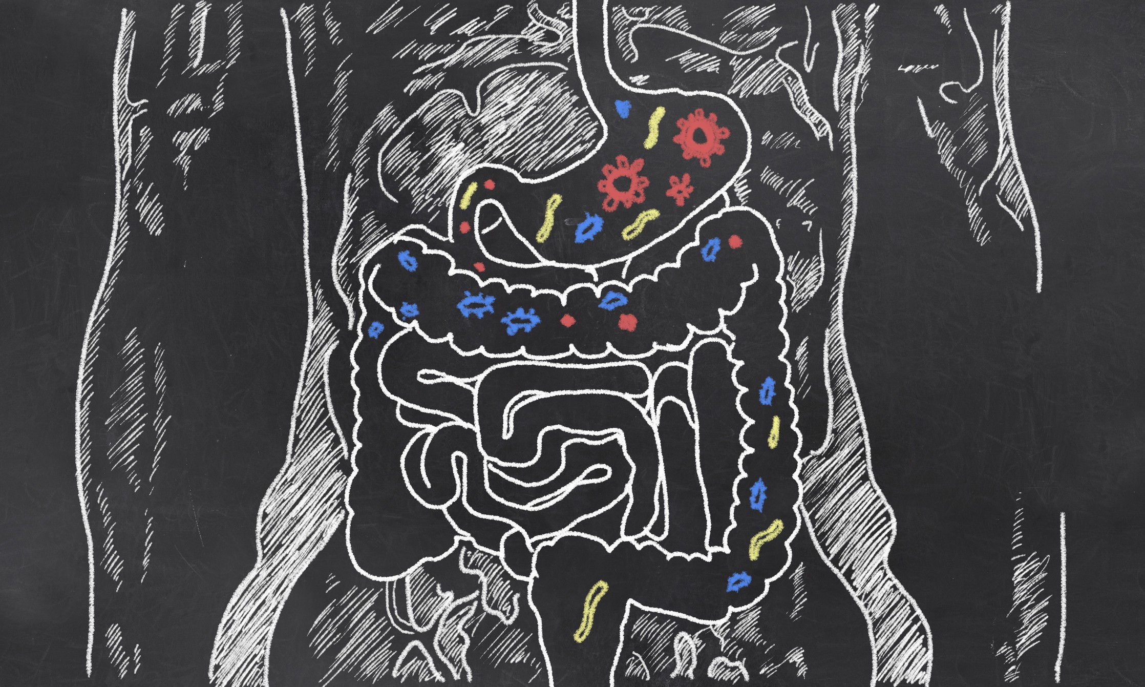 Diagram illustrating leaky gut, showing gaps in the intestinal lining allowing toxins and food particles to enter the bloodstream, contrasting with a healthy gut barrier.