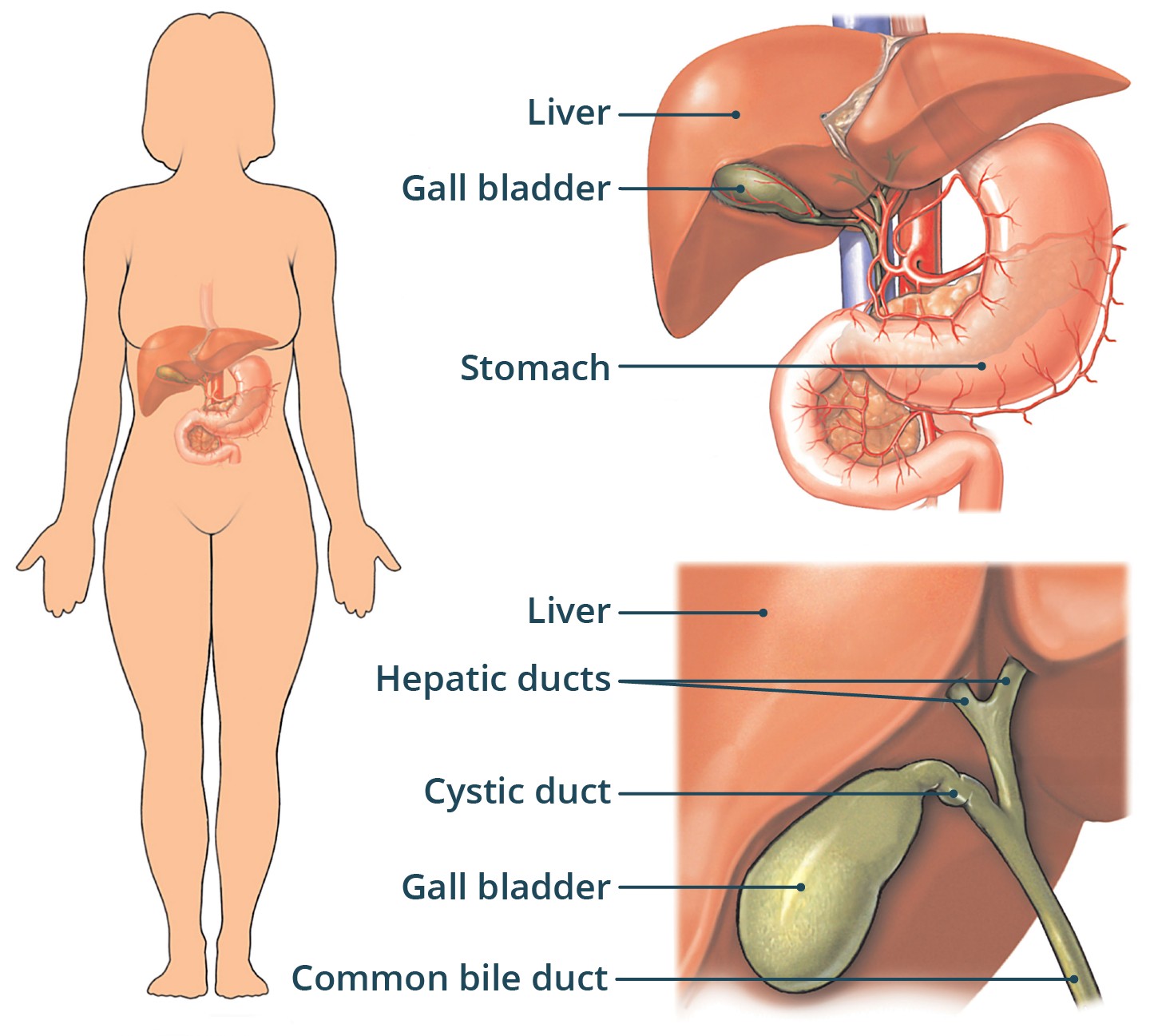 Gallbladder Location in the Upper Right Abdomen:  Anatomical illustration showing the gallbladder situated beneath the liver on the right side of the upper abdomen, highlighting its position relevant to understanding gallbladder pain and cholecystitis.