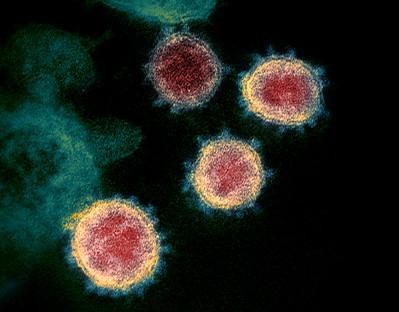 Microscopic view of SARS-CoV-2 virus particles showcasing spike proteins. This image helps visualize the coronavirus and its spike proteins, crucial for understanding how mRNA vaccines work by targeting these proteins to trigger an immune response.