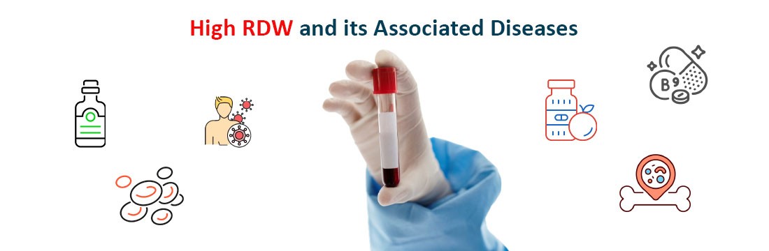 Blood Test for RDW