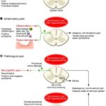 Nociceptive pain represents the sensation associated with the detection of potentially tissue-damaging noxious stimuli and is protective.