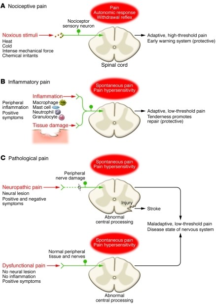 Nociceptive pain represents the sensation associated with the detection of potentially tissue-damaging noxious stimuli and is protective.