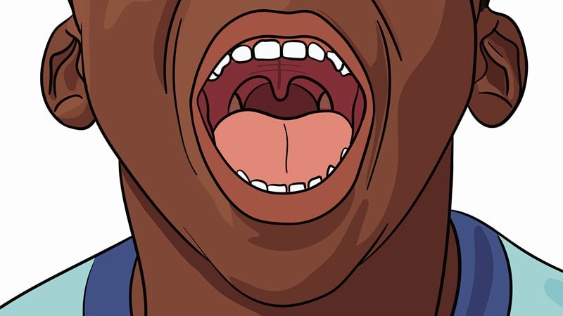 Illustration of a healthy throat showing normal tonsils and tissues